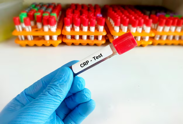 How Does a CRP ELISA Kit Work for Measuring Inflammation